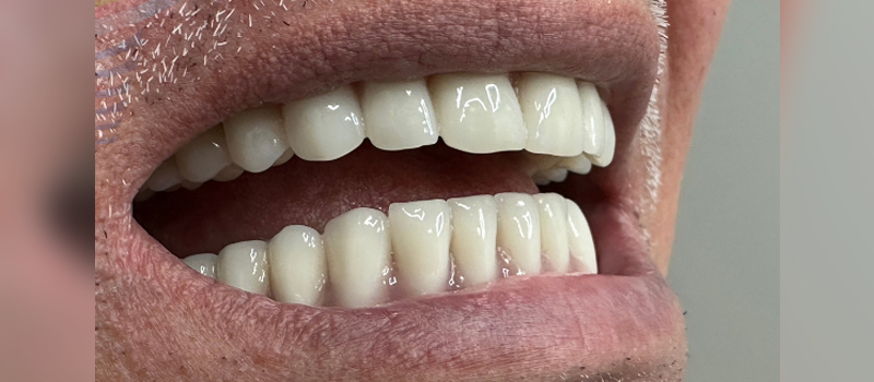 Website-Before-After-image-3-6-2